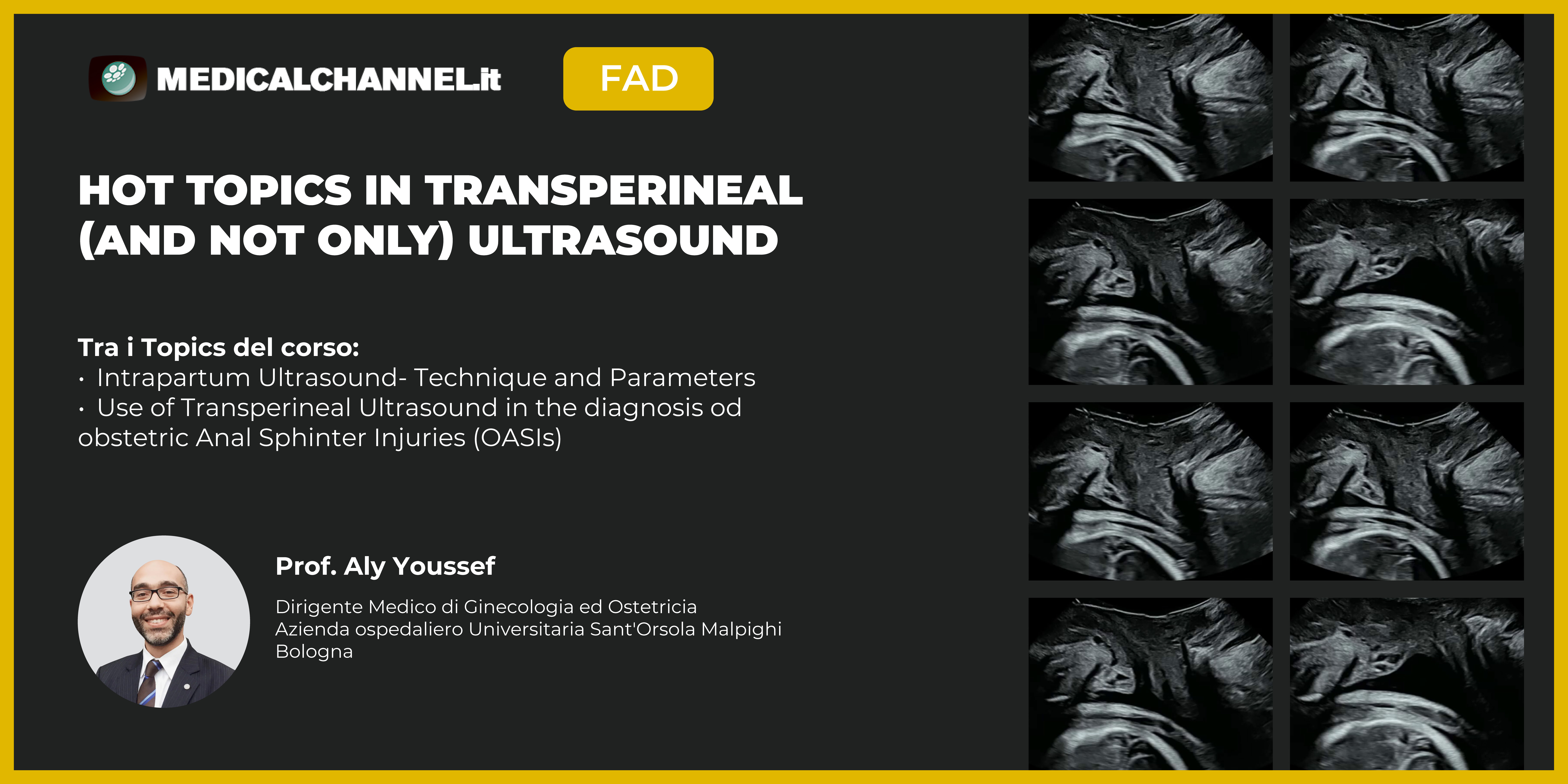 Hot Topics in Transperineal (and not only) Ultrasound
